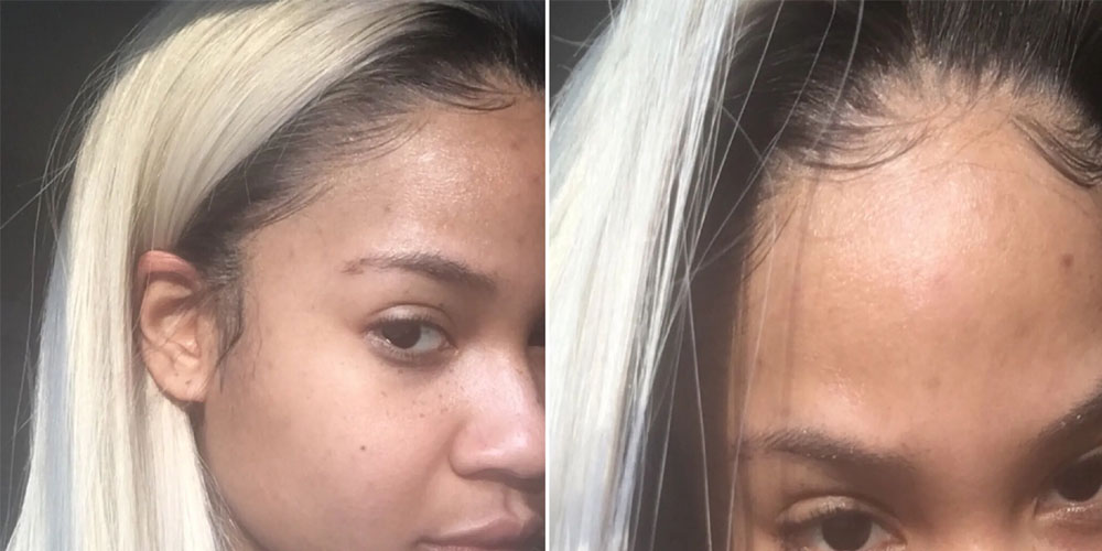 Is It Beneficial To Wear Lace Front Wig at Night